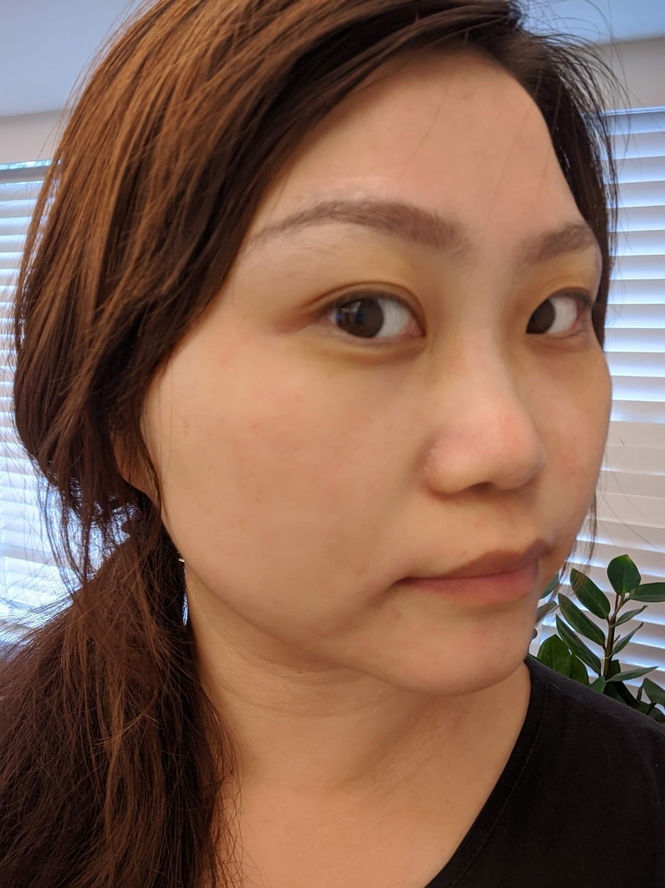 【皮秒雷射】星和診所-光復南路(仁愛)- 女人就該為了自己的肌膚好好的呵護保養，懂得愛自己！！！～-媽咪寶貝分享趣